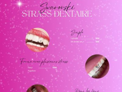 Strass Dentaire